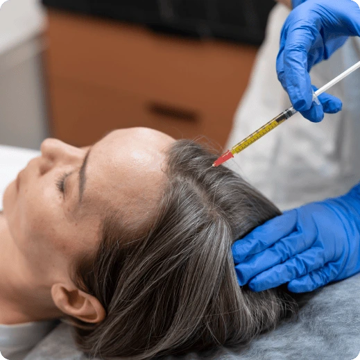hair-transplant