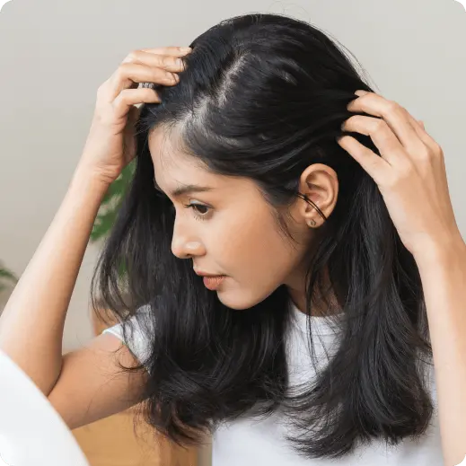 scalp-treatment