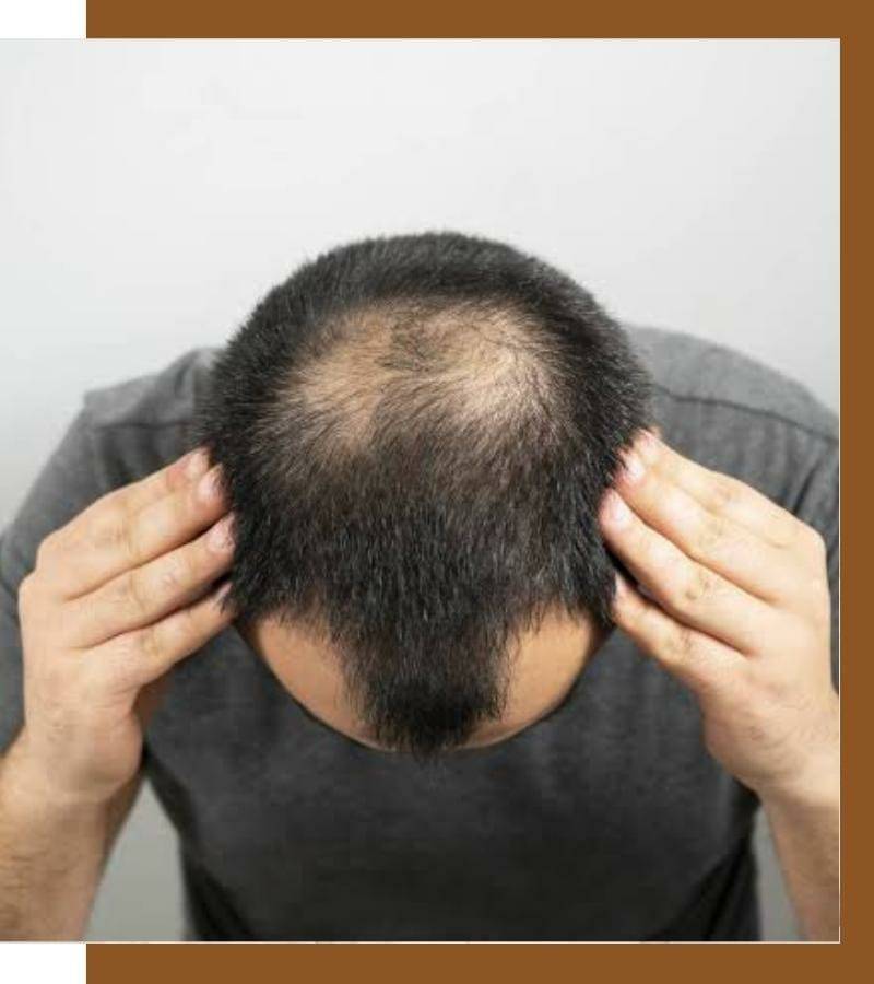 Best Hair Loss Treatment Center In Hyderabad