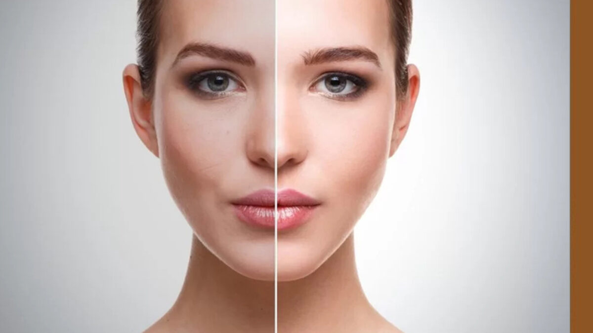 Skin Whitening Treatment, Procedure, Cost, and Side Effects - Dermiq Clinic