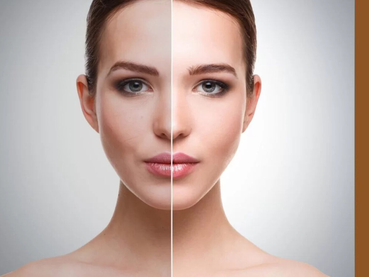 Skin Whitening Treatment, Procedure, Cost, and Side Effects - Dermiq Clinic