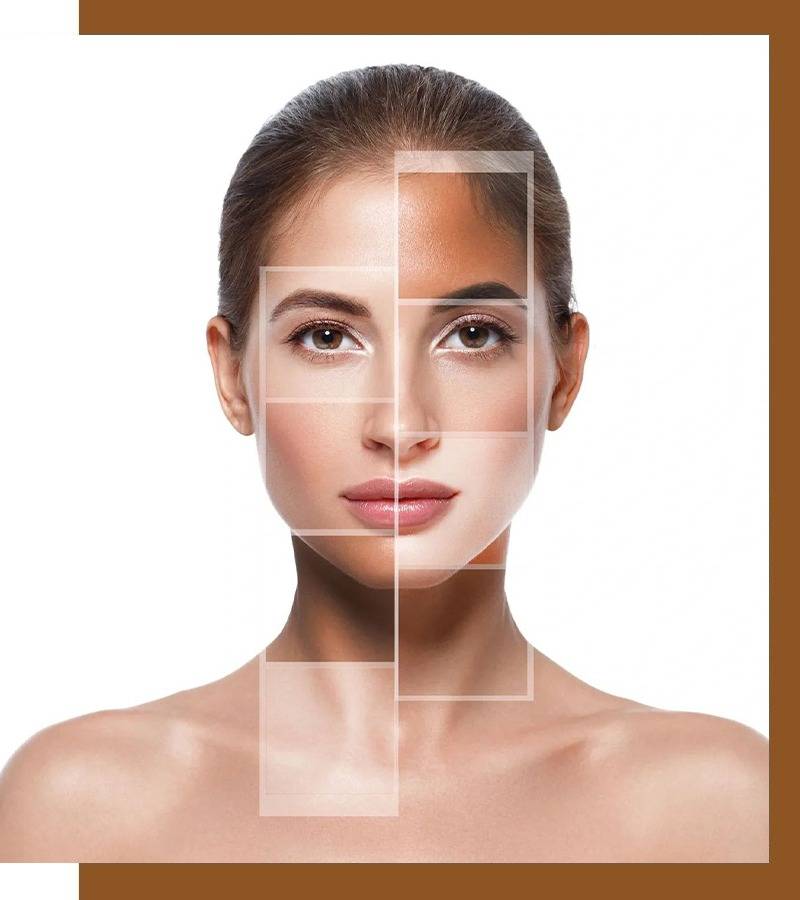 Uneven skin tone treatments