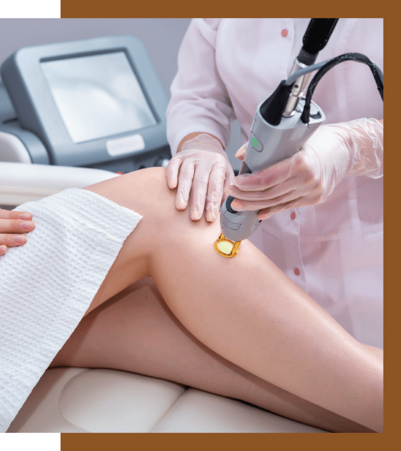 Laser Hair Removal, The Ultimate, Complete Guide To Laser Hair Removal, Dermiq Clinic