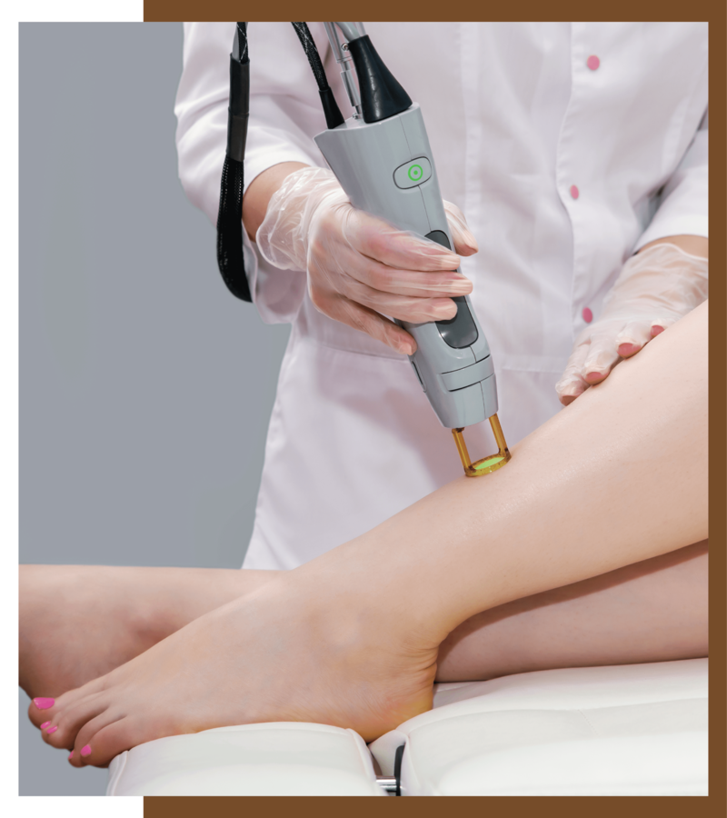 Laser Hair Removal Treatment in Hyderabad, Say Goodbye to Unwanted Hair with Laser Hair Removal Treatment in Hyderabad, Dermiq Clinic