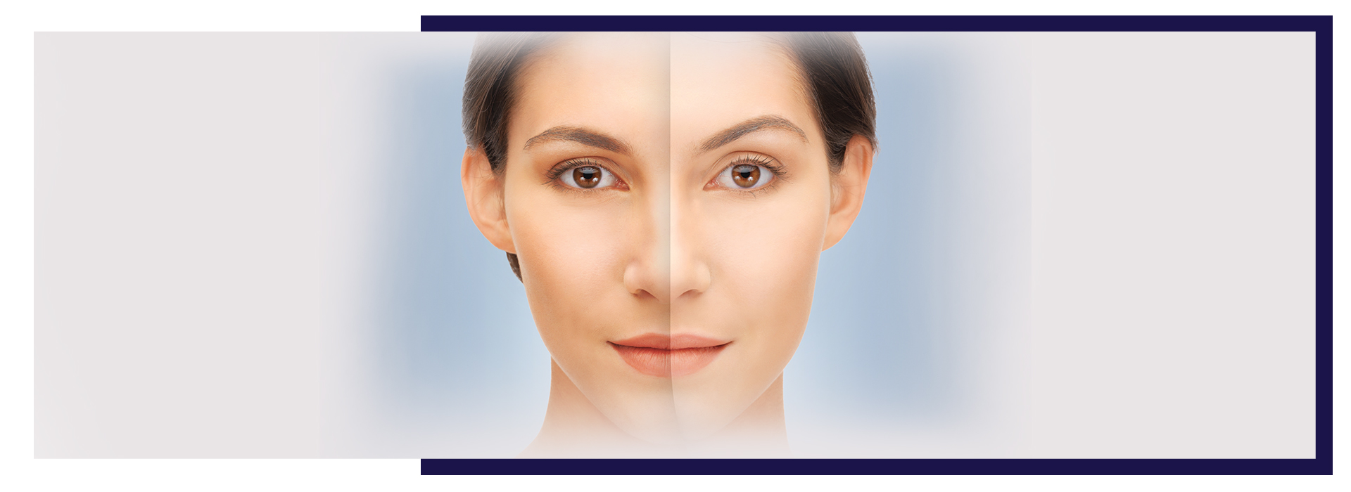 Skin Whitening, Permanent Skin Whitening: Laser Procedure and Treatment Cost in Hyderabad, Dermiq Clinic