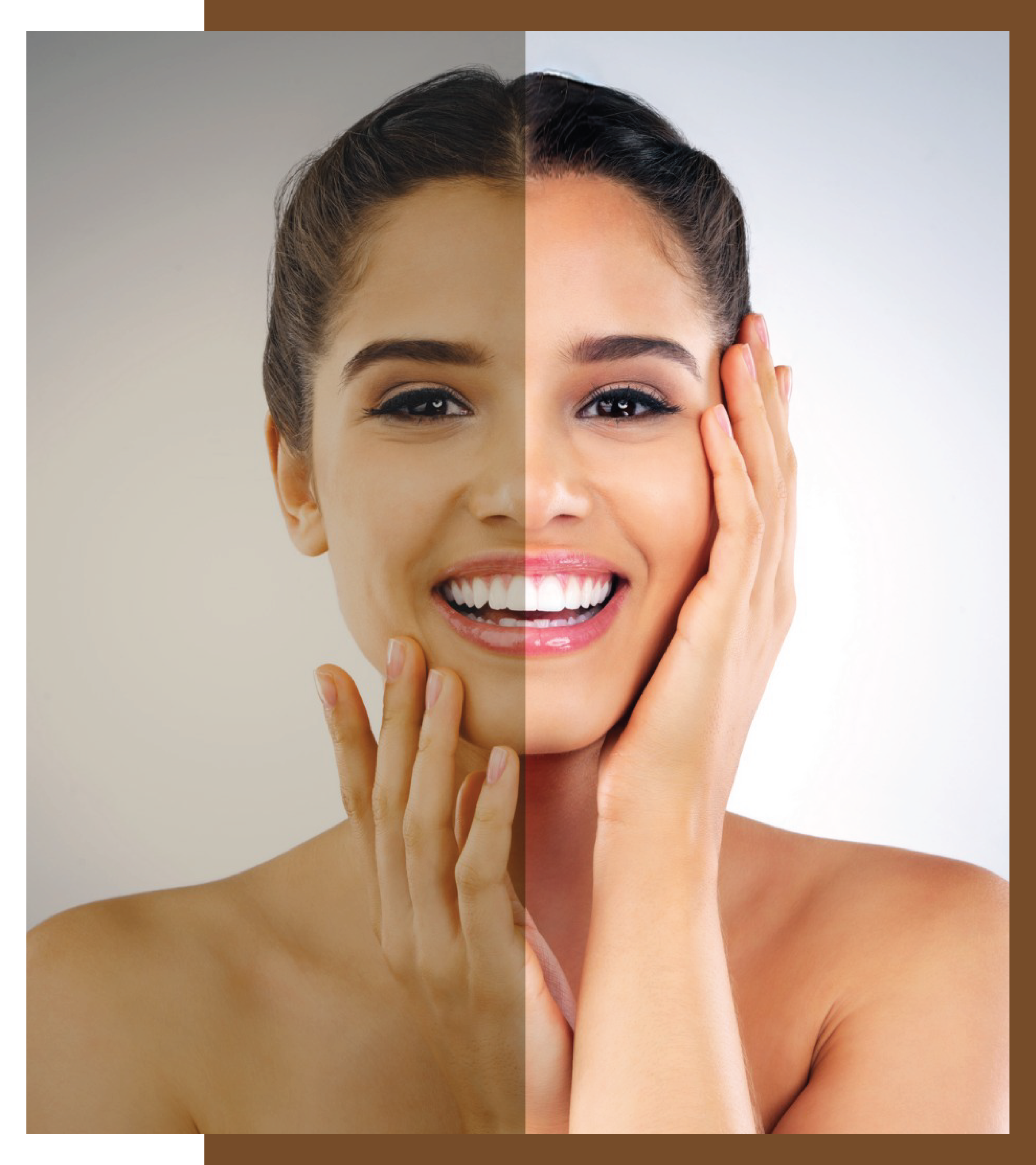 , Transform Your Complexion: The Power of 50% Off Acne Treatment Services, Dermiq Clinic