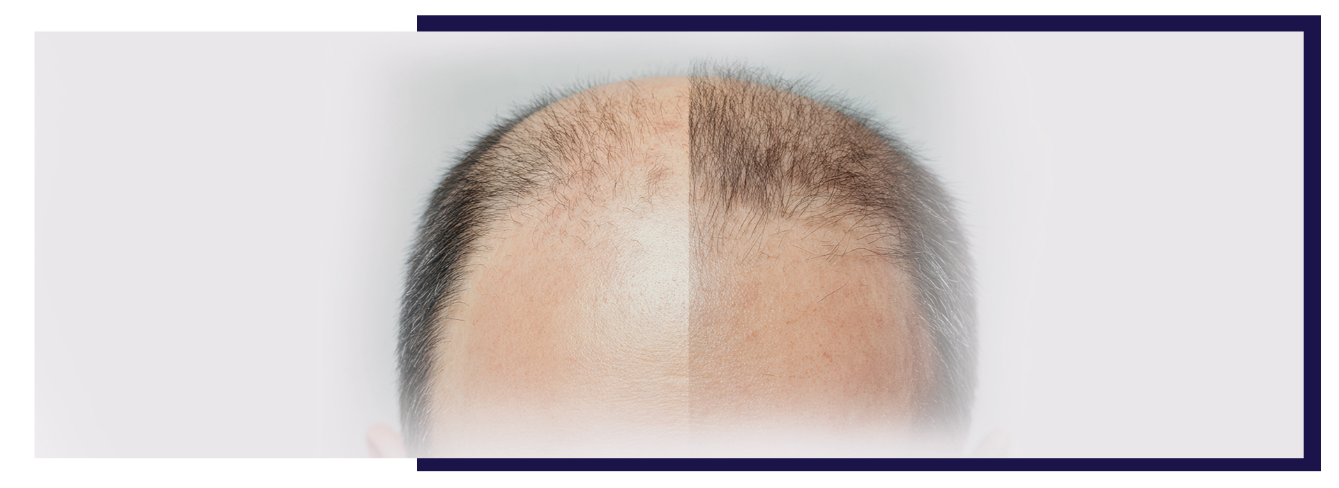 , Blog, Dermiq Clinic