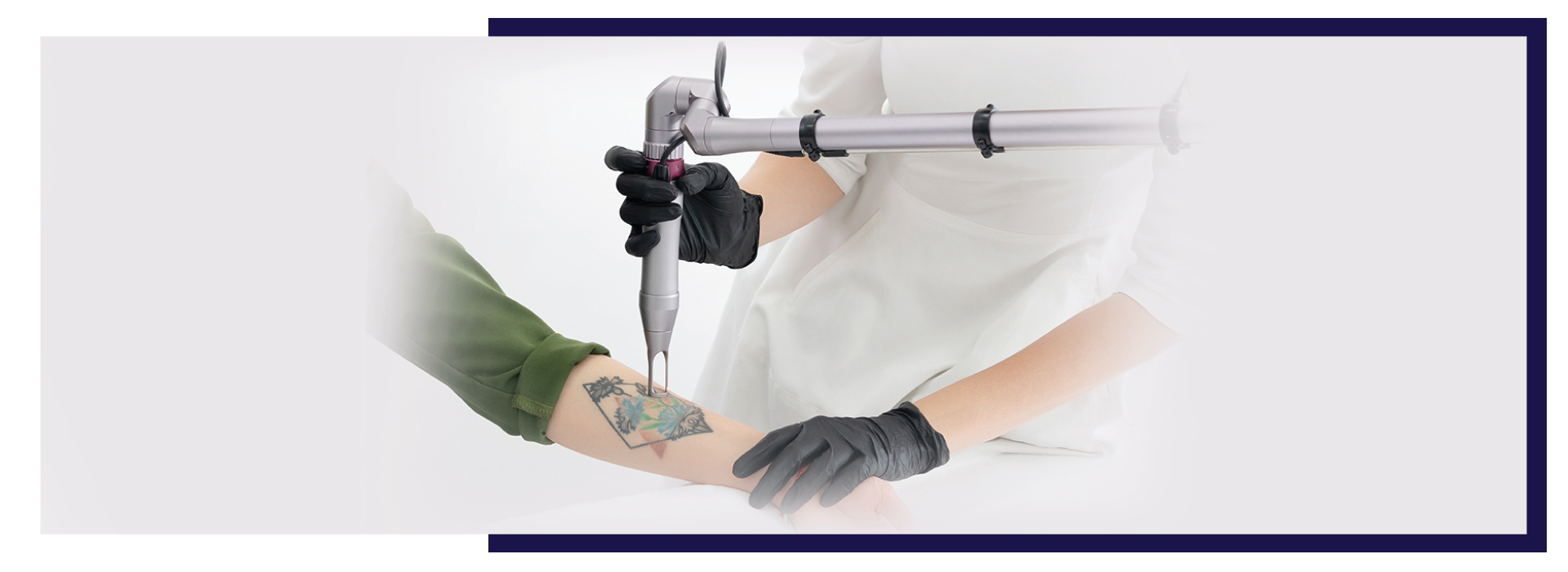 Laser Hair Removal FAQs, Tattoo Removal: How It Works, Process, Healing &#038; Scarring, Dermiq Clinic