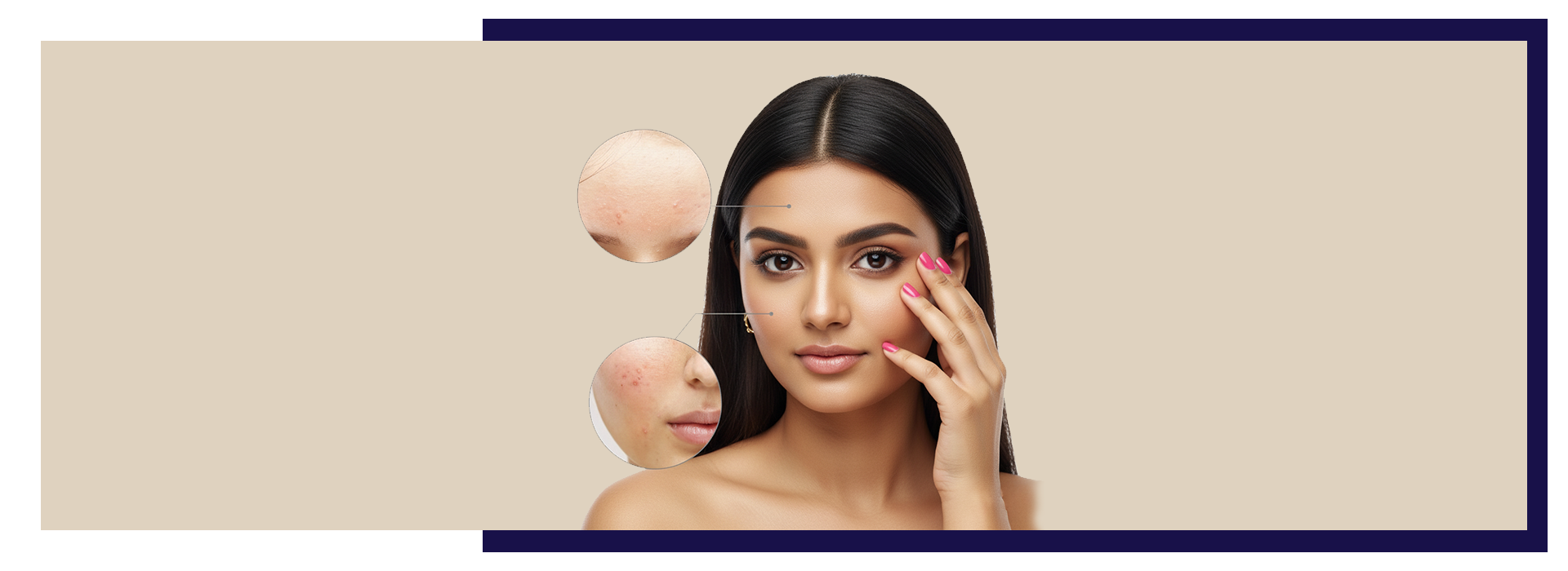 , Scar Treatment Options That Actually Work: From Lasers to Creams, Dermiq Clinic