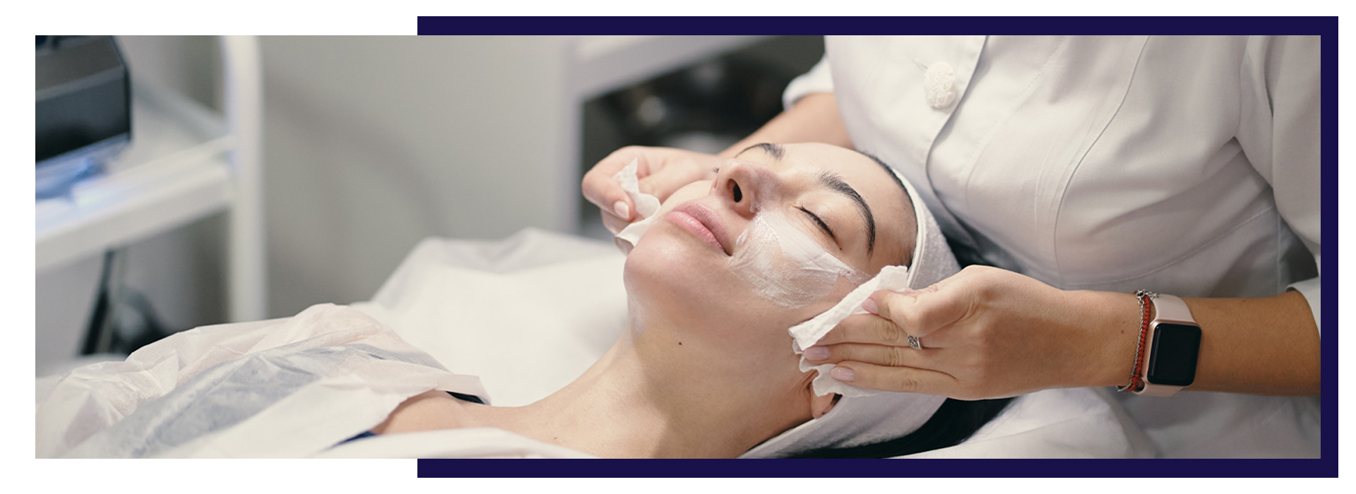 Stress on Skin Health acne, The Impact of Stress on Skin Health and How to Manage It Holistically, Dermiq Clinic