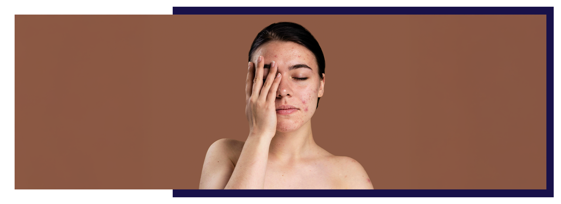 , Blog, Dermiq Clinic