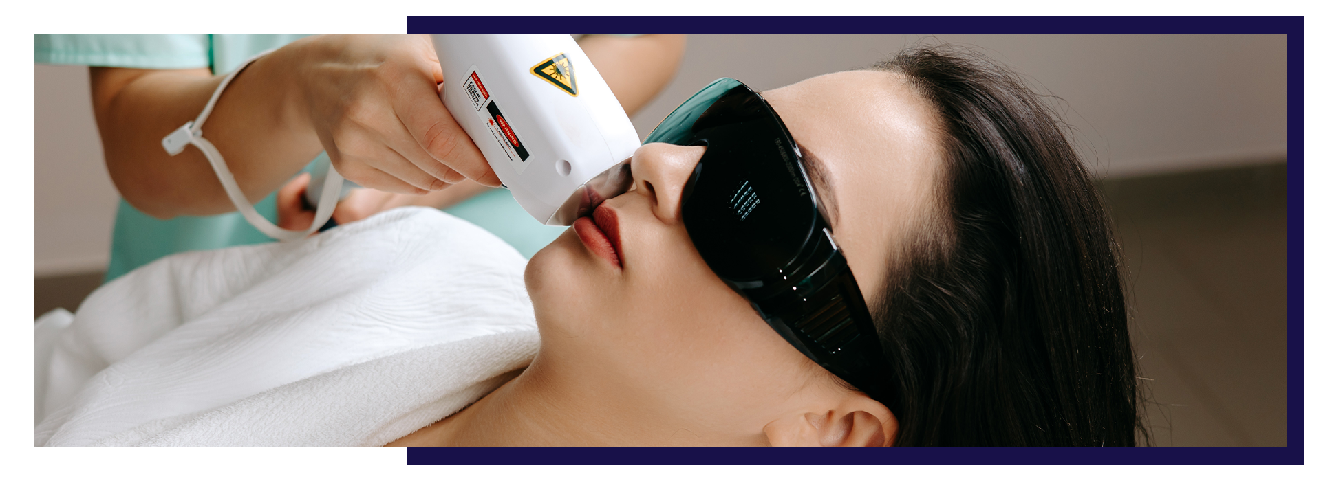 laser toning, laser toning treatment, laser toning benefits, laser toning side effects, what is laser toning, laser toning for face, laser toning for pigmentation, Why Laser Toning Is the Best Solution for Pigmented Skin, Dermiq Clinic