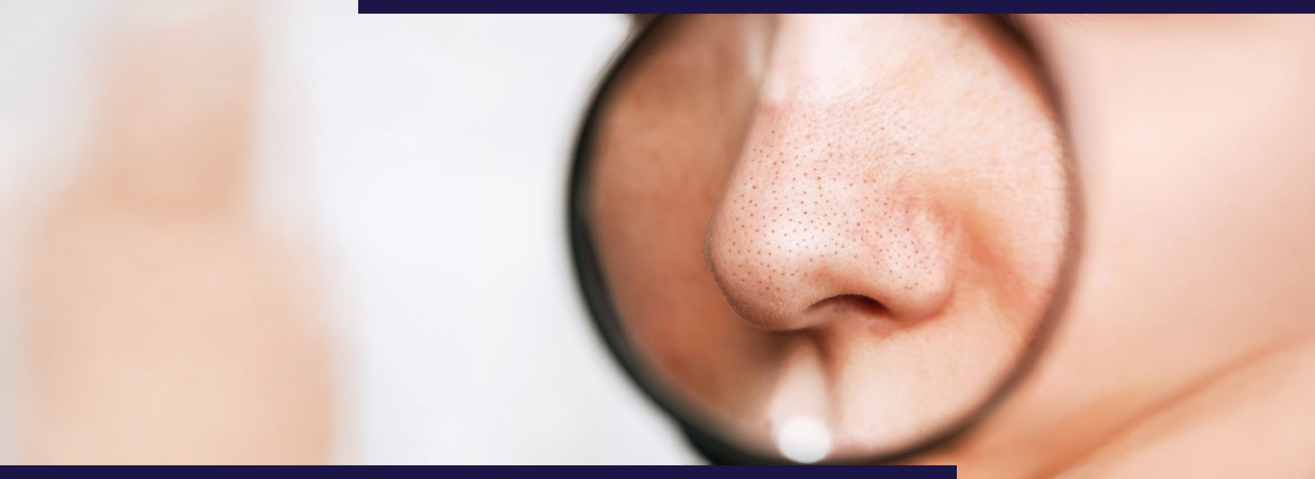 , Blog, Dermiq Clinic