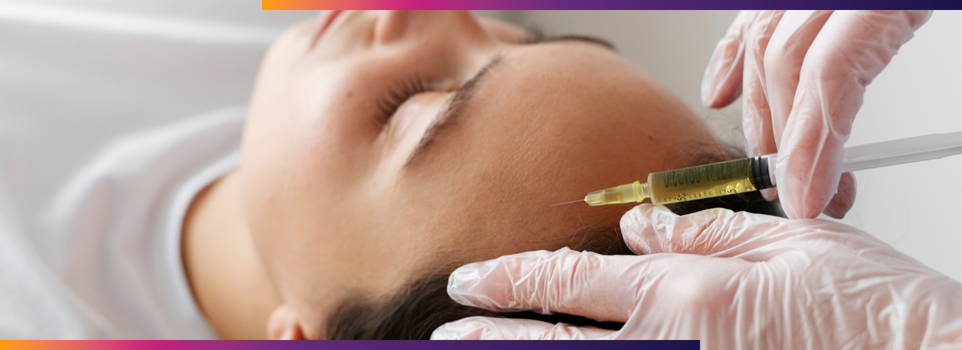 PRP Sessions for Hair Loss, How Many PRP Sessions for Hair Loss Are Needed? | Dermiq Clinic, Dermiq Clinic