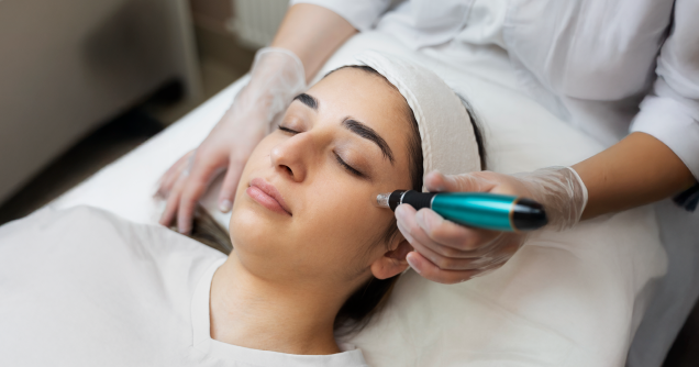 Ultherapy Lift Treatment