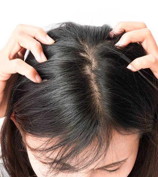 Keratin Hair Spa Treatment Anti-Dandruff Tea Tree Oil 6pcs | Shopee Malaysia