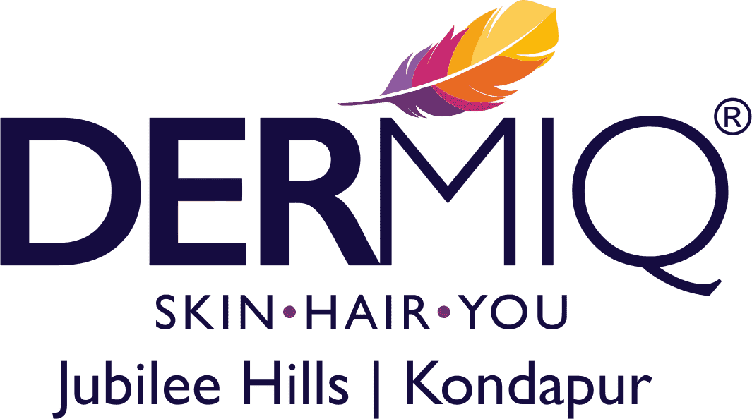 Best Hair Loss Treatment in Hyderabad | Dermiqclinic